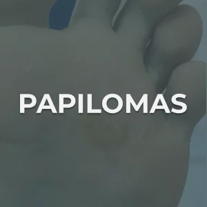papilomas